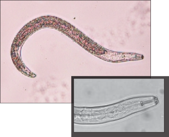 FIGURE 1. A root lesion nematode and a close look at the darkened stylet, diagnostic to this group of nematodes. This nematode is 0.5mm long, or half the thickness of a dime.