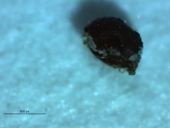 A) Dislodged cyst of species Heterodera filipjevi found on wheat roots in Chouteau County in 2014.