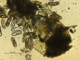 B) Another H. filipjevi cyst from the same location, which has burst, revealing a multitude of eggs within. Photos by R. Al-Khafaji.