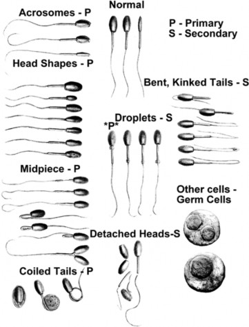 Drawing of normal and abnormal sperm cells that may be observed during a breeding soundness exam.