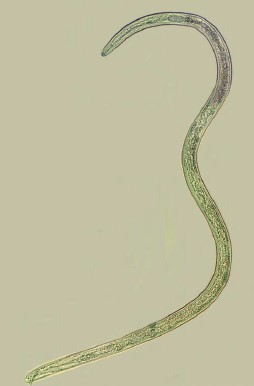 A juvenile soybean cyst nematode