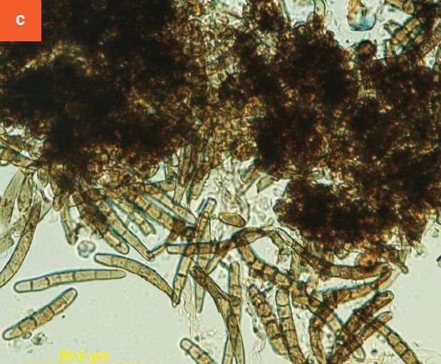 A close-up of Stigmina sp. spores.